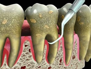 Soft Tissue Management Therapy