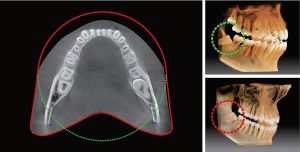 CBCT Imaging