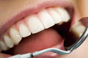 The Importance of Regular Dental Check-Ups