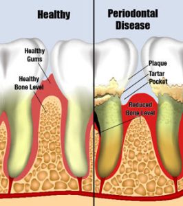 The Ultimate Destination for Dental Care in Seminole, Florida