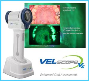 VELscope